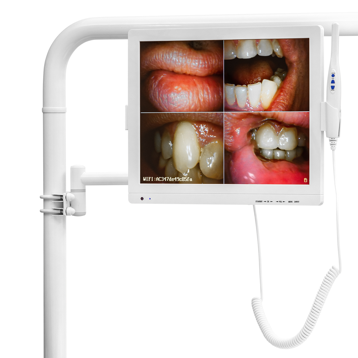 Комплекс визуализации Woson